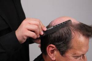 Premium 100% human hair system by Cosmetica Hair Studio — natural hairline, hand-tied lace base, undetectable craftsmanship